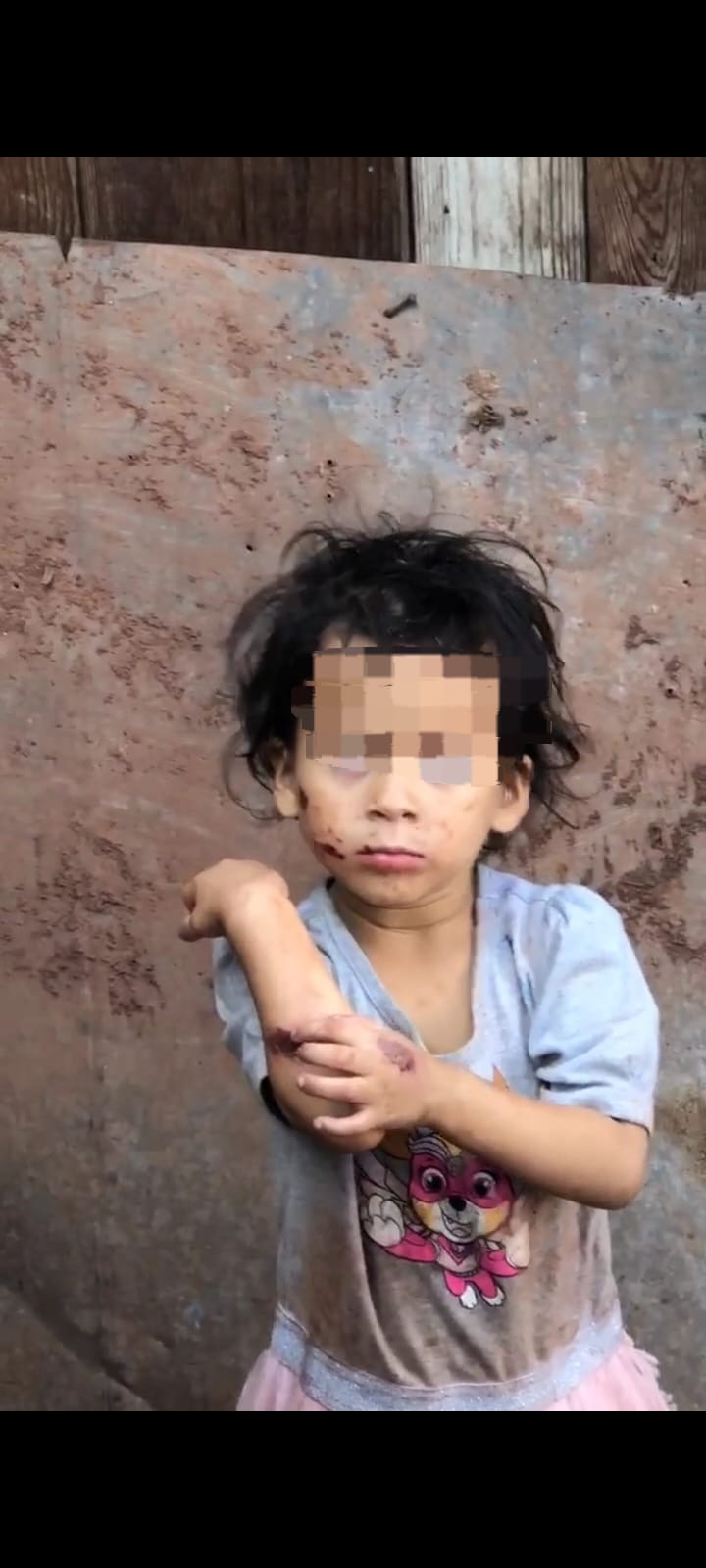 “Policías rescatan a dos niñas víctimas de maltrato y arrestan a su madre; se gestionará un futuro seguro para las menores”